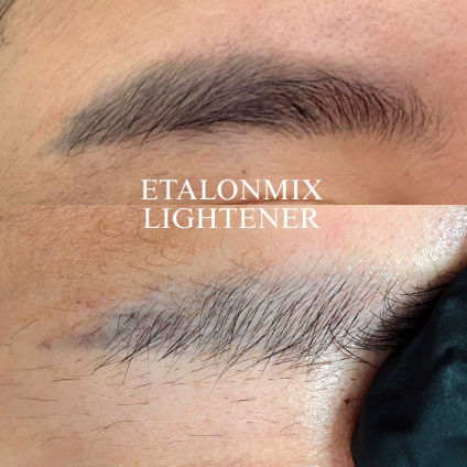 Eyebrow Tattoo Removal Bangkok